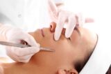 Dermaplaning, ¿la mejor opción para eliminar el vello facial?